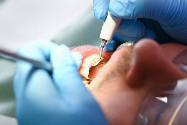 Best Walk-In Emergency Dentist in Templeton, CA