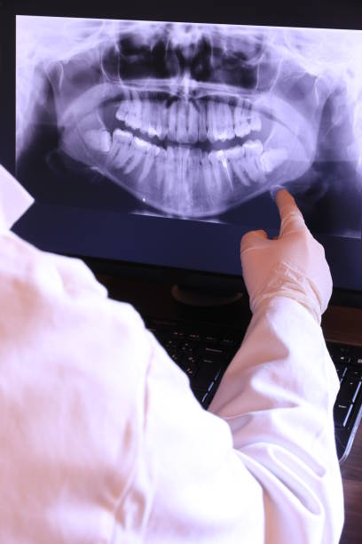 Best Emergency Dental Surgery in Templeton, CA